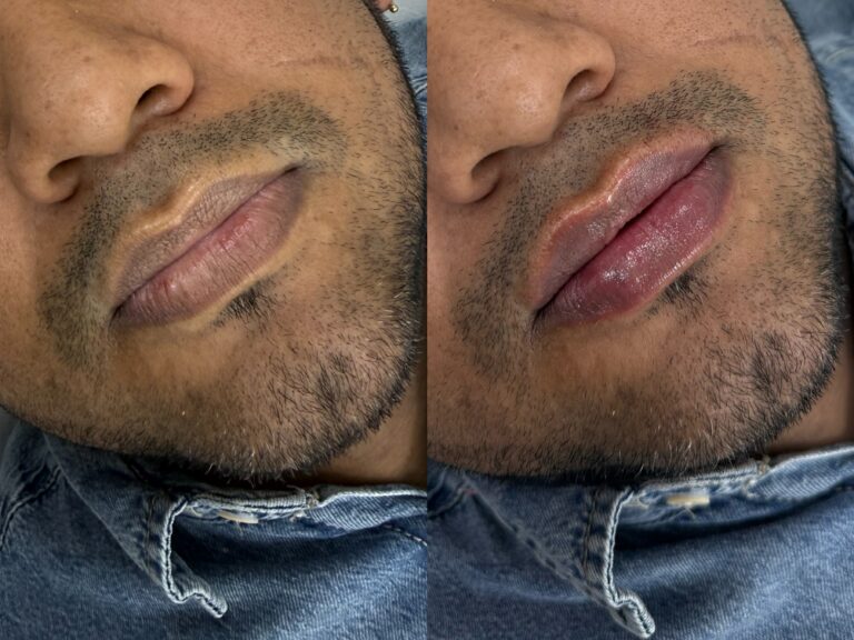 Processed with MOLDIV