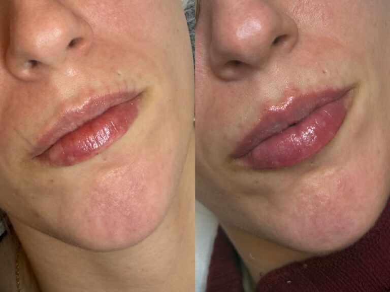 Processed with MOLDIV