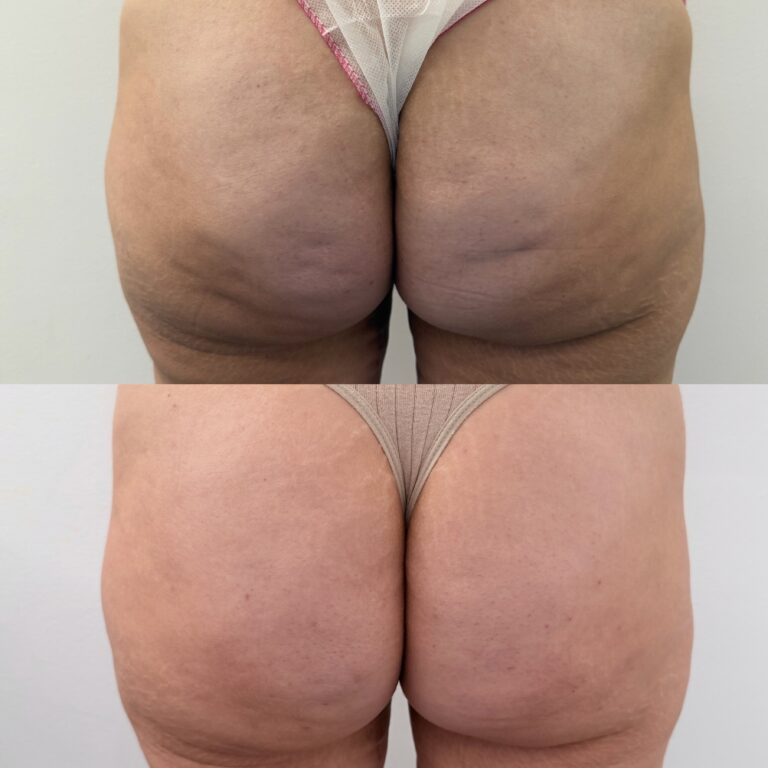 Processed with MOLDIV