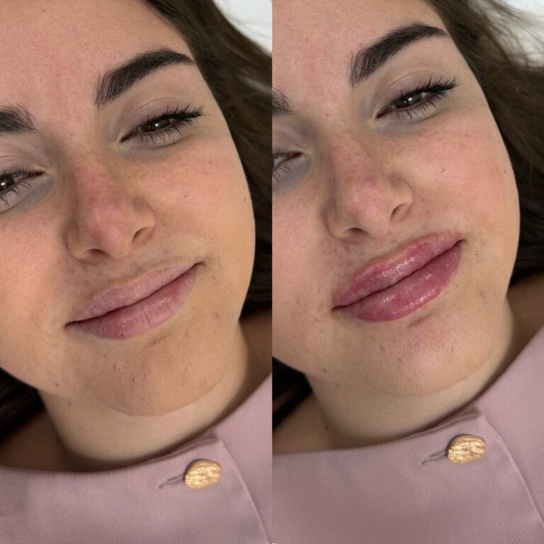 Processed with MOLDIV