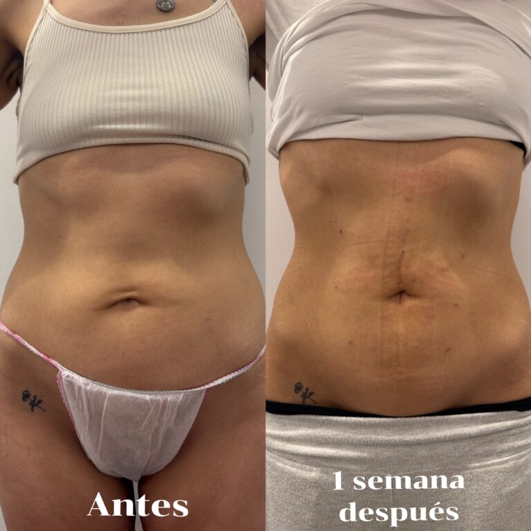 Processed with MOLDIV