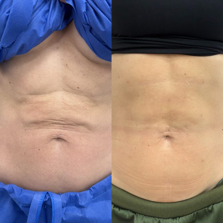 Processed with MOLDIV